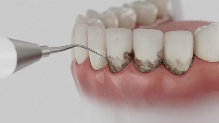 Trusted Dental Crowns And Bridges service in Carnegie, OK - Dentist Open Now